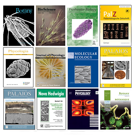 Professor Peter Siver's stunning images of algae have appeared on 12 journal covers.